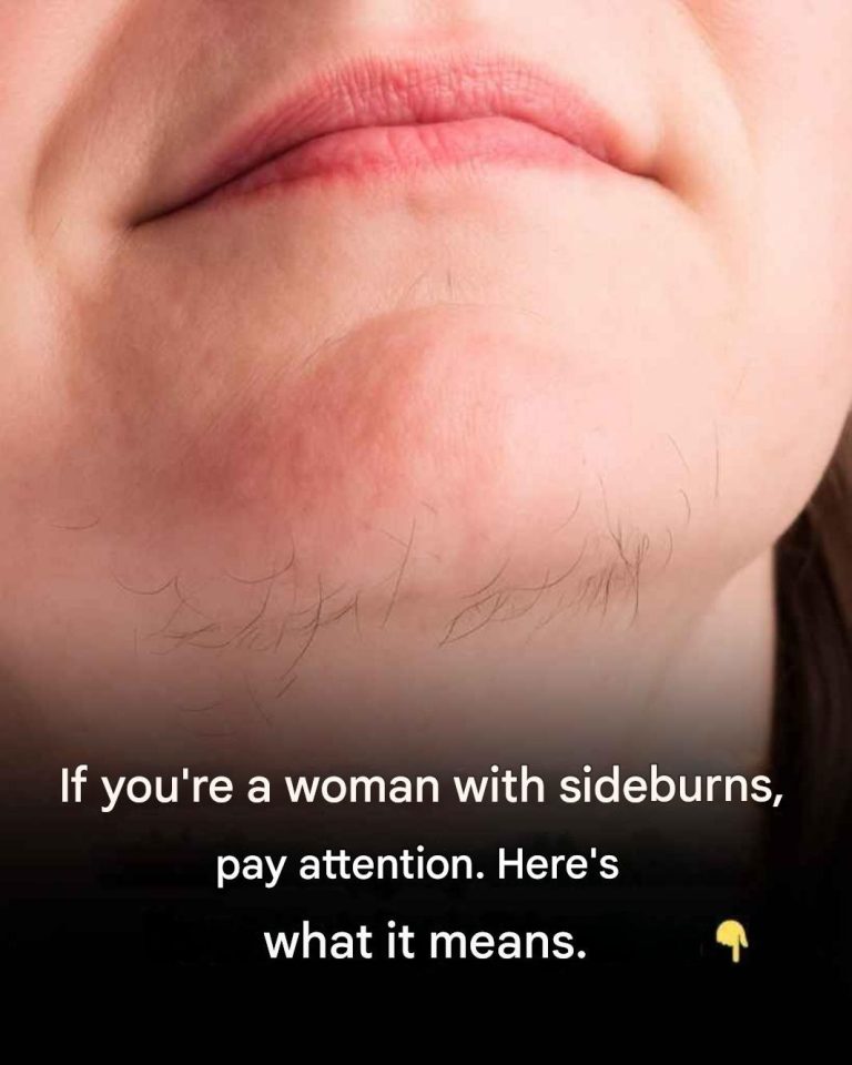 What your chin whiskers might tell you about your health
