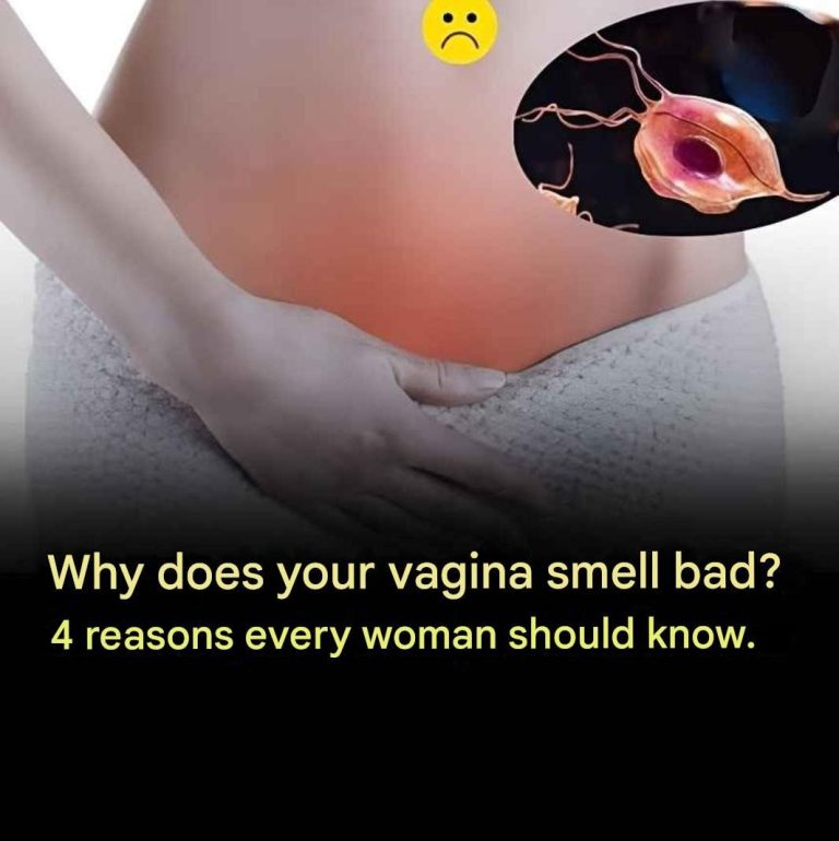 Why does your vagina smell bad? 4 reasons every woman should know.