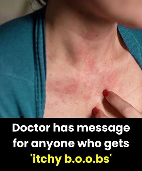 Doctor has message for anyone who gets ‘itchy bo.o.bs’
