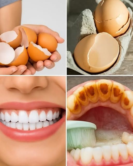 Brighten Your Smile Naturally with Kitchen Ingredients