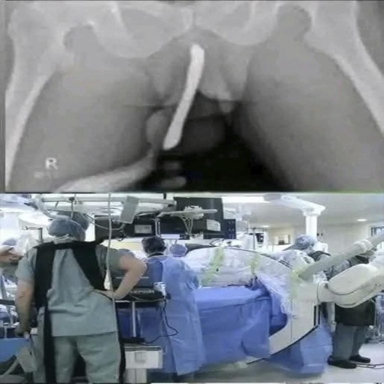 Young woman hospitalized after experiencing…