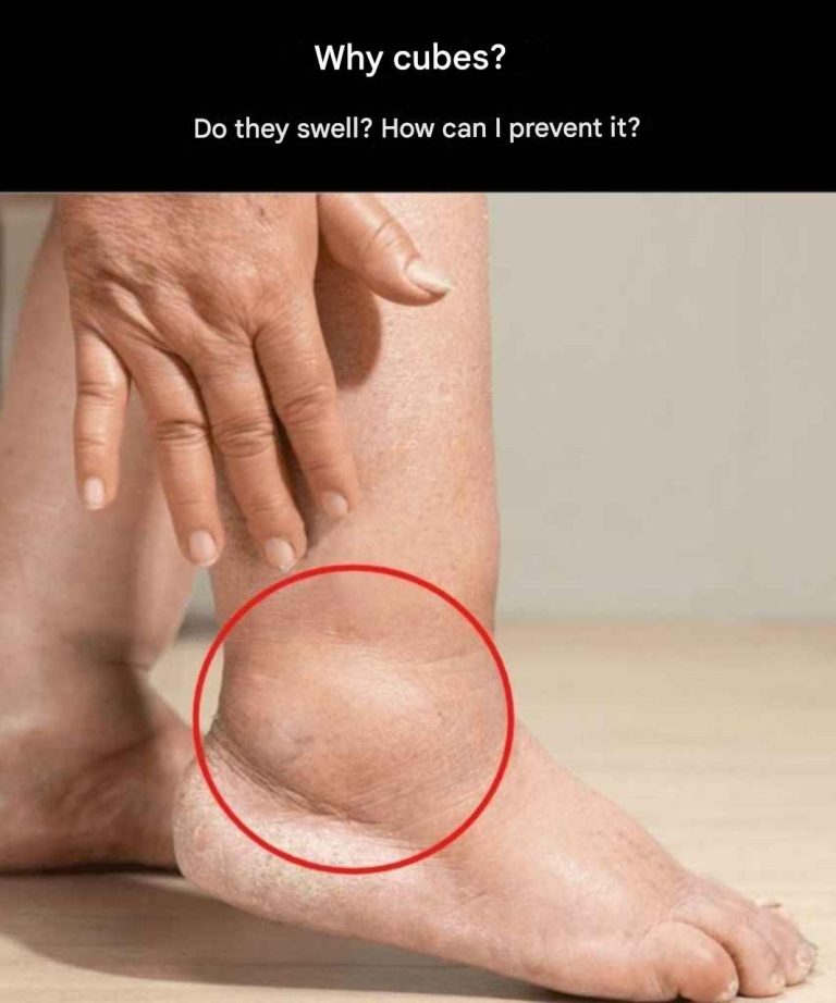 Swollen legs: what are the symptoms and how to solve the problem?