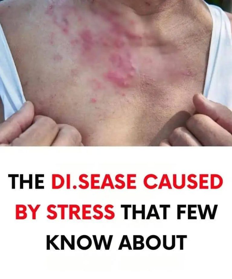The dis.ease caused by stress that few know about