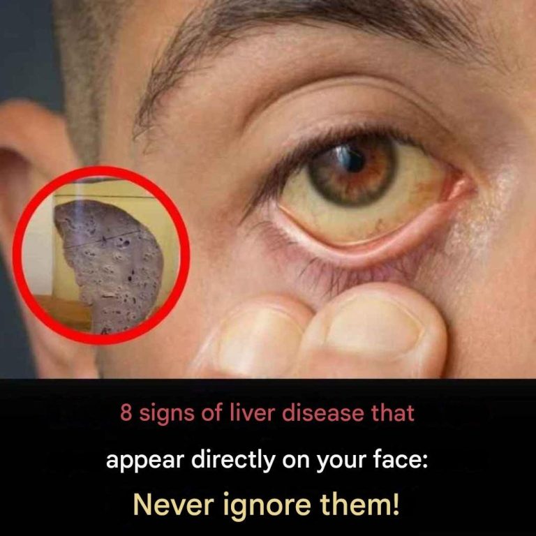8 facial signs that may indicate liver disease: doctors urge the public not to ignore them