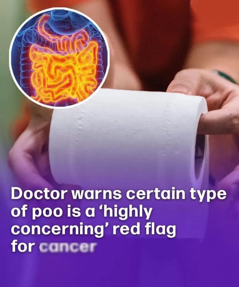 Doctor says certain type of poo is a ‘highly concerning’ red flag for ca.n.cer