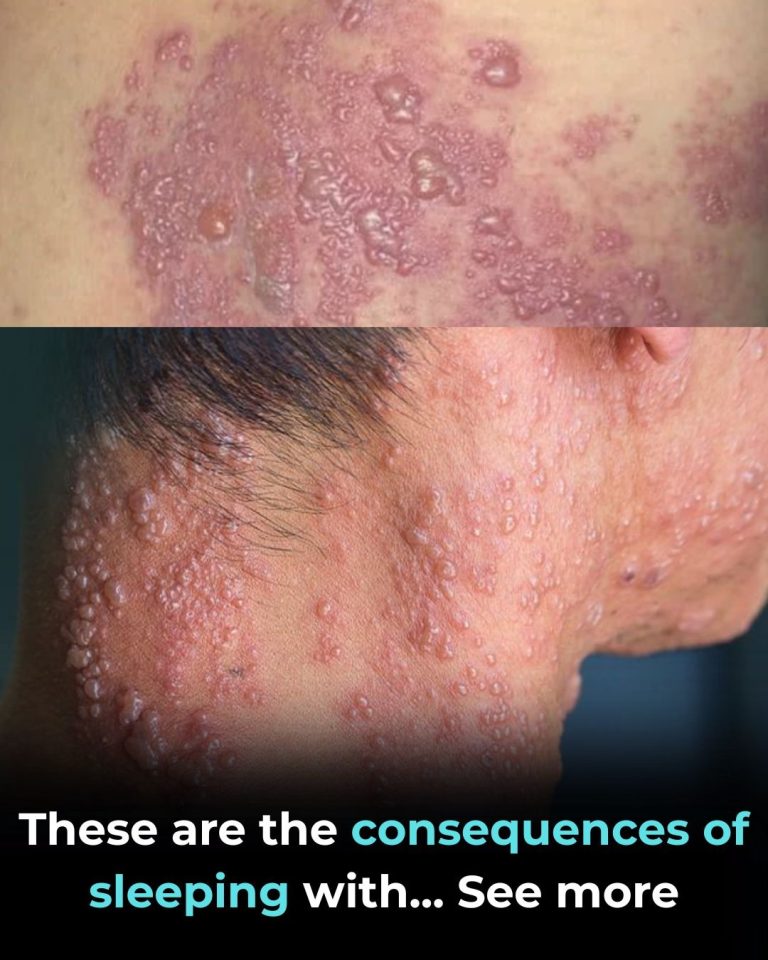 These Are the Consequences of Sleeping with Someone Who Has HPV — What Every Man Needs to Know