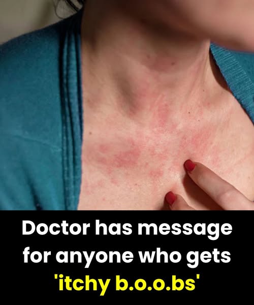 Doctor has message for anyone who gets ‘itchy bo.o.bs’