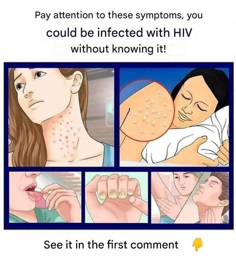 HIV: The First Symptoms You Should Not Ignore.