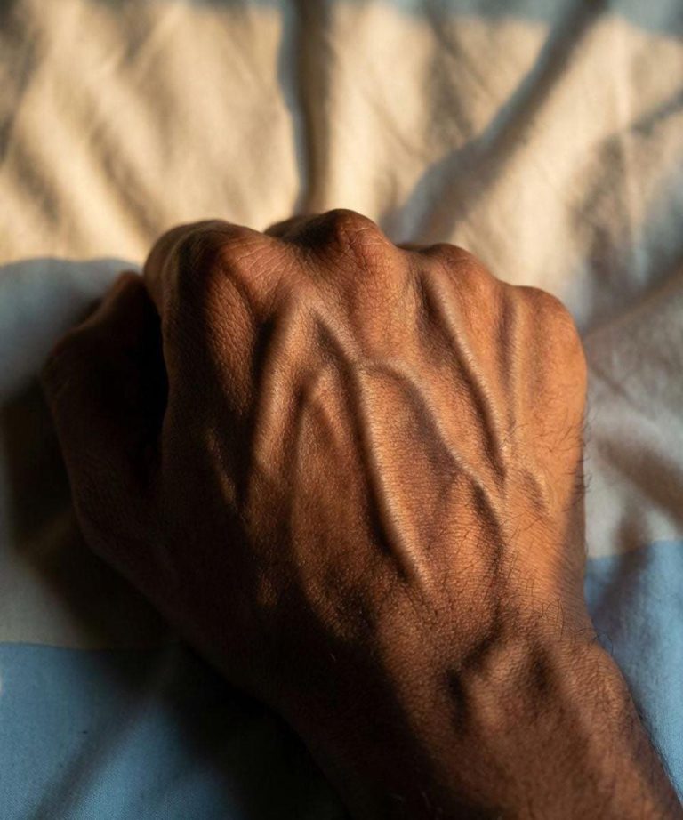 Why Your Veins Look More Visible at Night