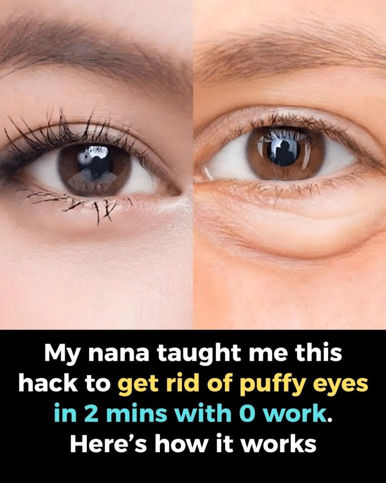 My nana taught me this hack to get rid of puffy eyes in 2 mins with 0 work. Here’s how it works
