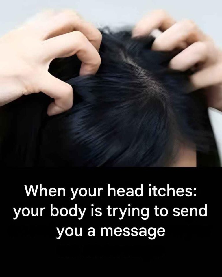 Itchy head? Here are the main causes