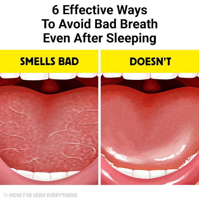 6 Effective Ways To Avoid Bad Breath Even After Sleeping