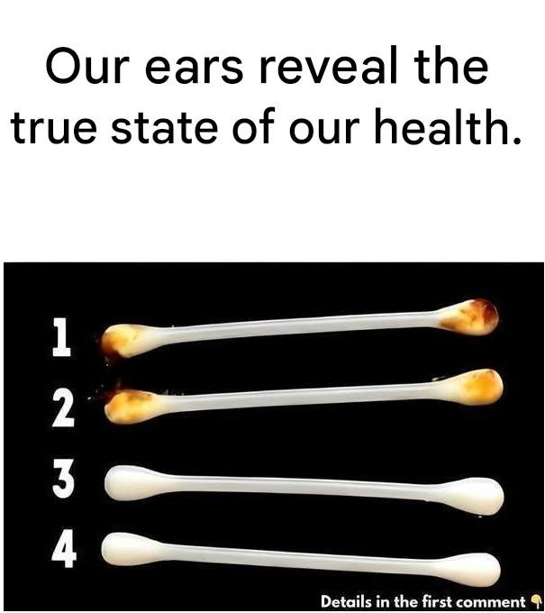 Our ears reveal the true state of our health.