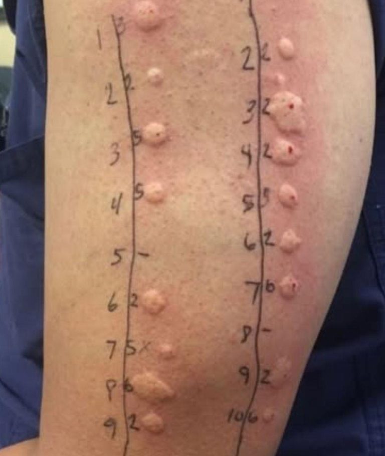 What Happens When You Sleep Too Cold