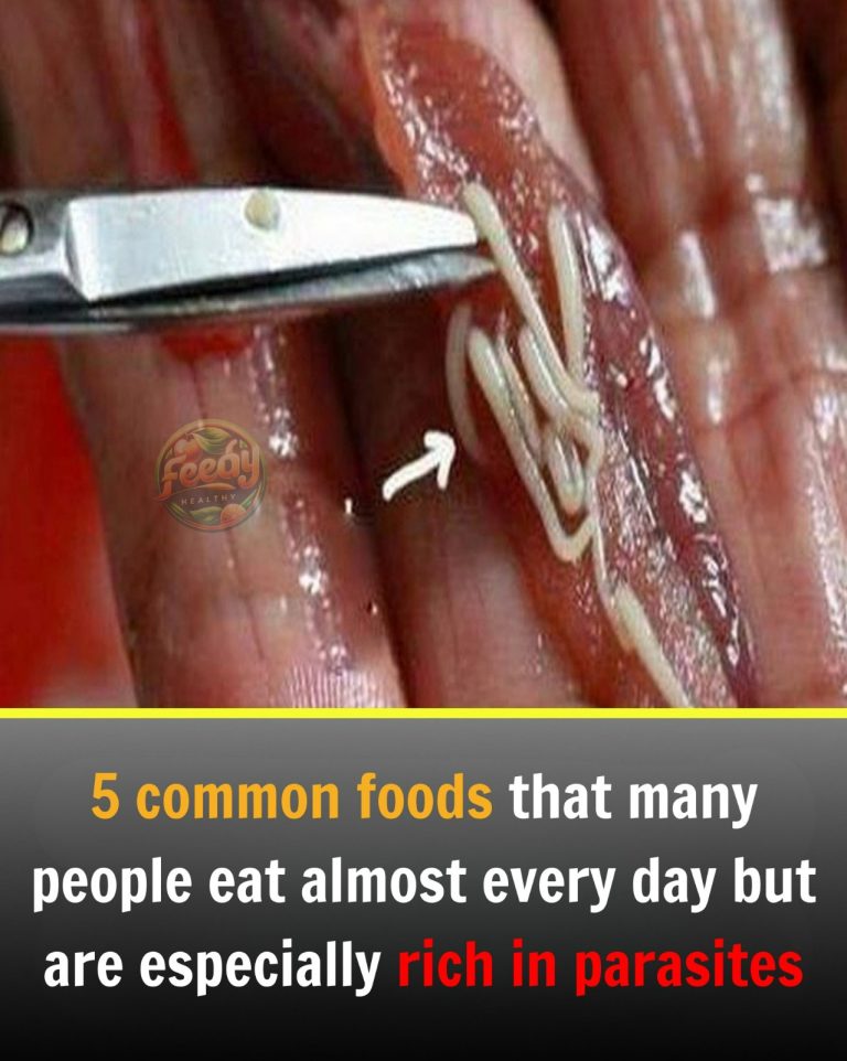 5 Foods That Can Carry Parasites — And How to Eat Them Safely