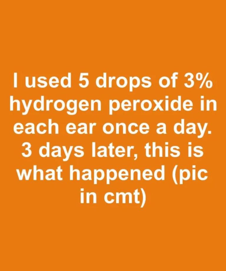 I used 5 drops of 3% hydrogen peroxide in each ear once a day. 3 days later, this is what happened