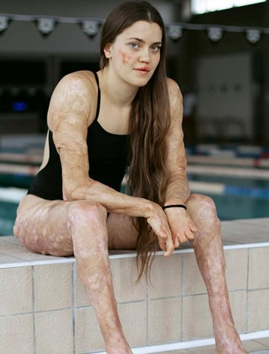 These are the consequences of sleeping with the…See more