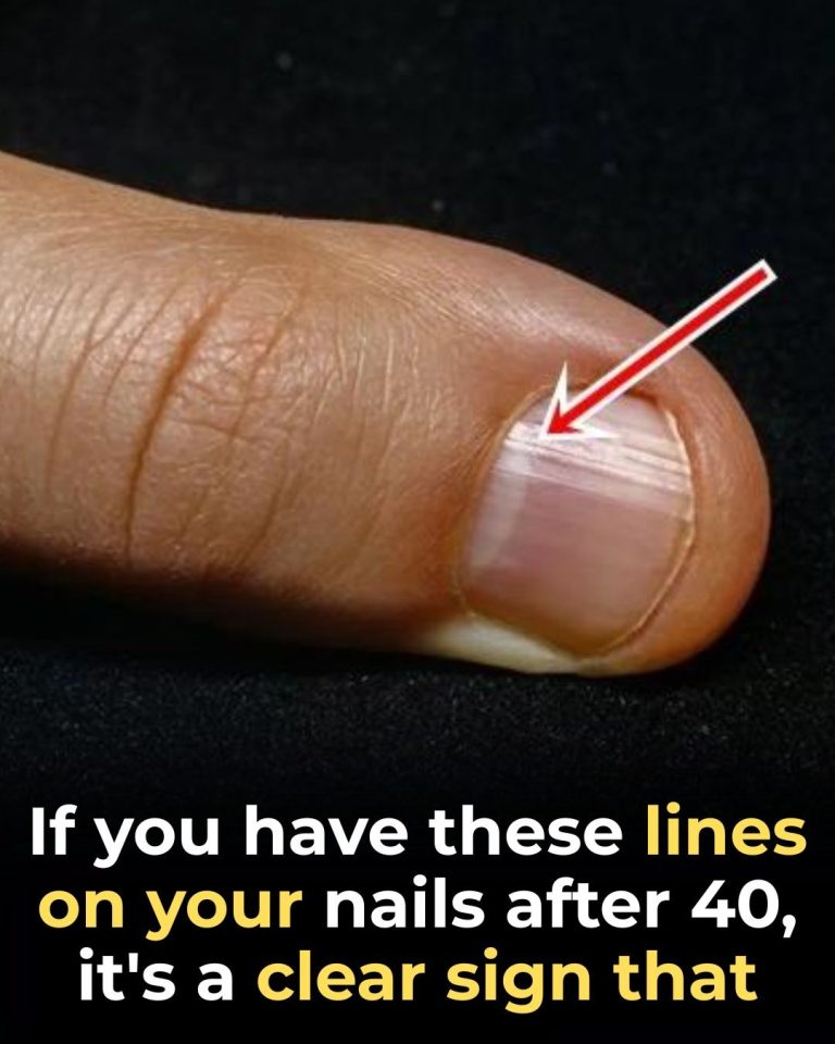 The Best Foods for Stronger Nails After 40 Check in comment 👇
