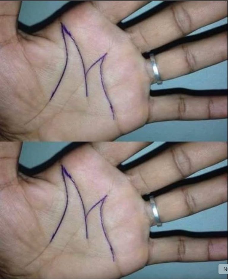 Why an ‘M’ Pattern Appears on Some People’s Palms