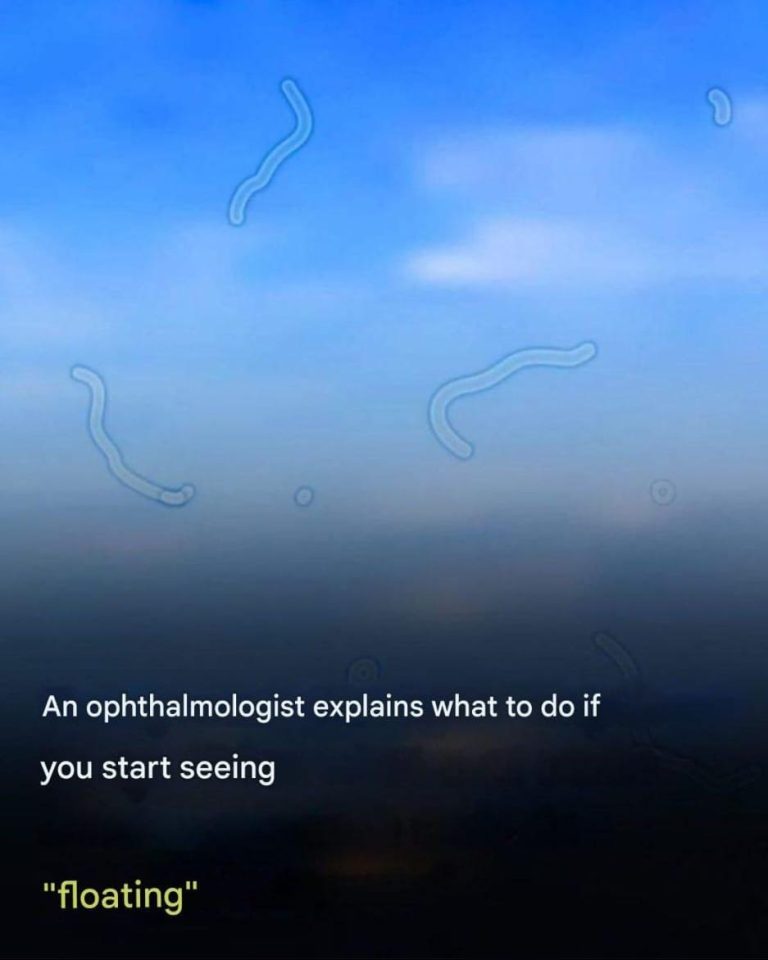 What are floaters? Here’s what you should do if you see them.