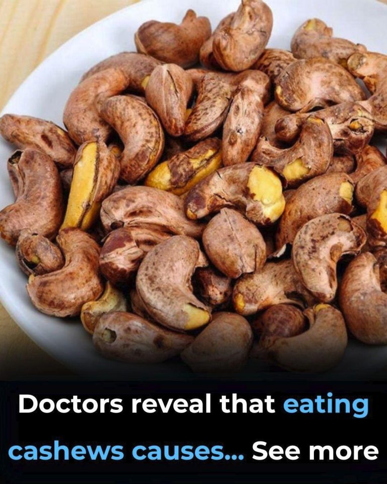 Doctors reveal that eating cashews causes