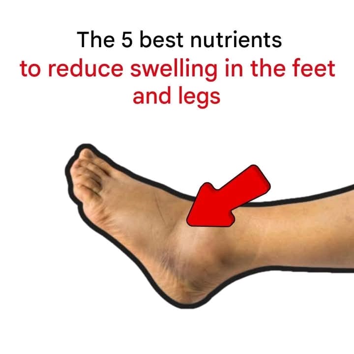 The 5 best nutrients to reduce swelling in the feet and legs