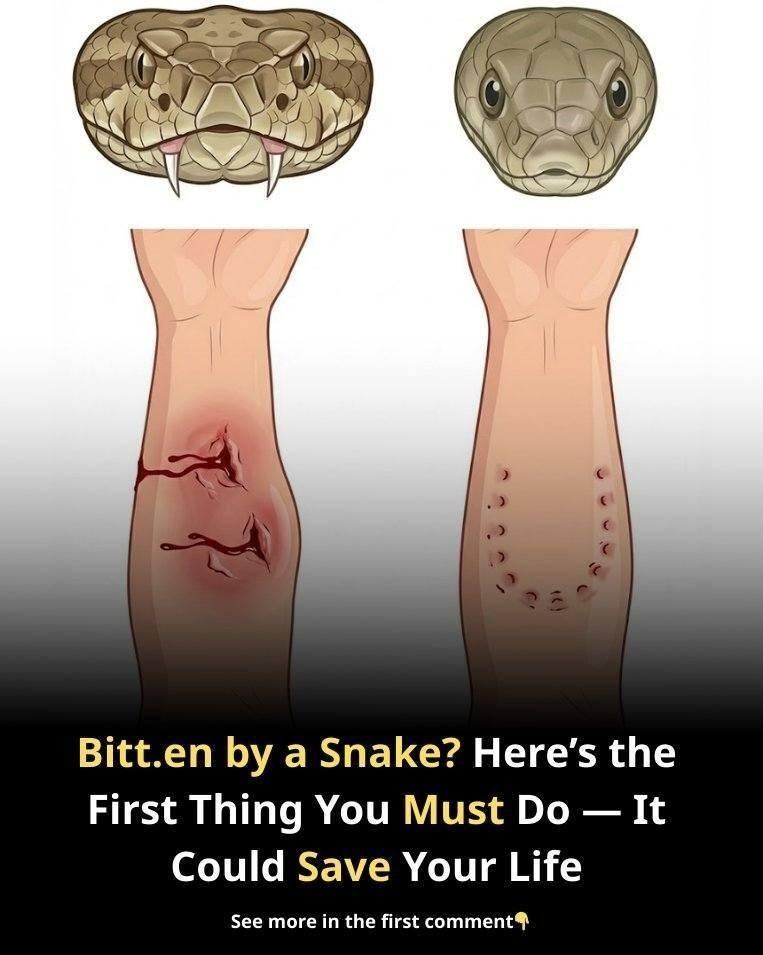 Bitten by a Snake? Here’s the First Thing You Must Do — It Could Save Your Life