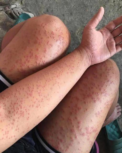 These are the consequences of sleeping with…