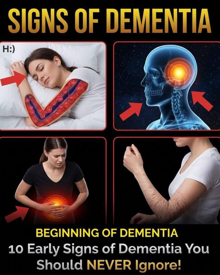 10 Signs of Dementia You Should Never Ignore