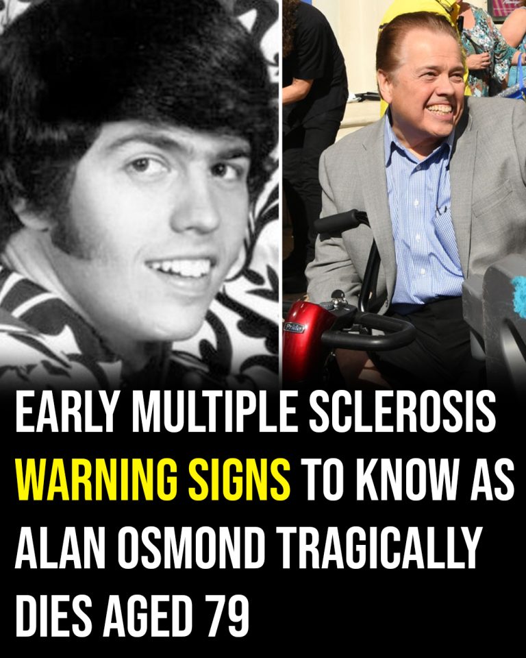 Early Multiple Sclerosis warning signs to know as Alan Osmond dies aged 79