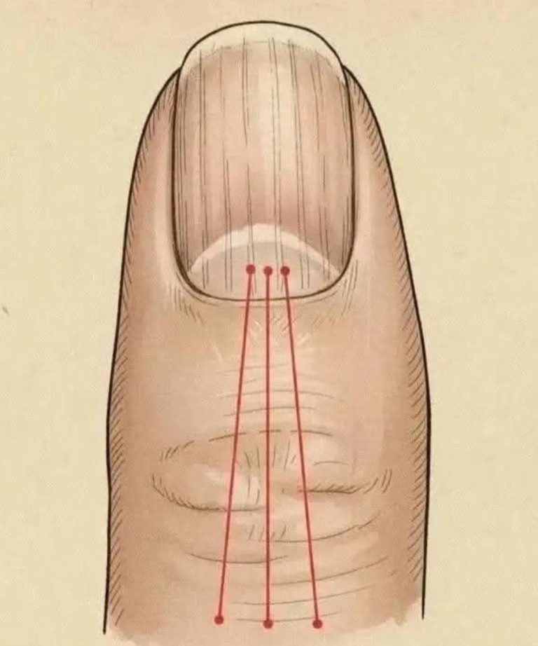 If you have these lines on your nails, you should pay attention.
