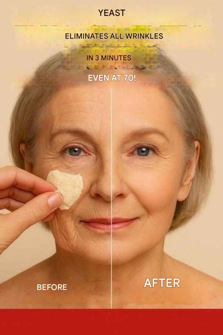Yeast removes all wrinkles in 3 minutes. Even at 70 years old. Wrinkle removal.