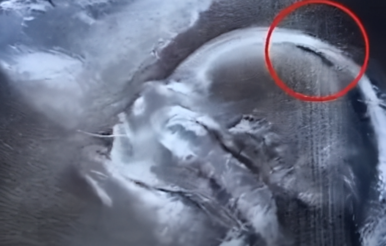 Doctors couldn’t believe what they saw during the ultrasound